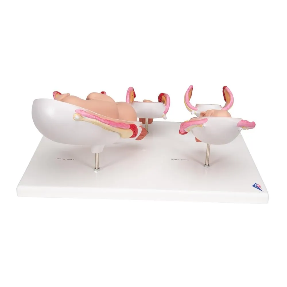 Pregnancy Series - 5 Models